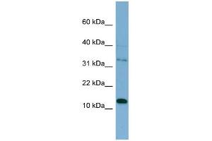 WB Suggested Anti-PHLDA2 Antibody Titration: 0. (PHLDA2 antibody  (Middle Region))