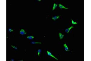 Immunofluorescence staining of SH-SY5Y cells with ABIN7143610 at 1:140, counter-stained with DAPI. (AKTIP antibody  (AA 1-292))