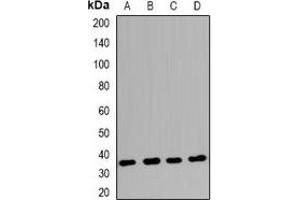 Western blot analysis of Claudin 17 expression in Raji (A), BT474 (B), K562 (C), mouse hrart (D) whole cell lysates. (Claudin 17 antibody  (C-Term))