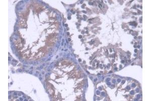 DAB staining on IHC-P; Samples: Mouse Testis Tissue (OS9 antibody  (AA 471-672))