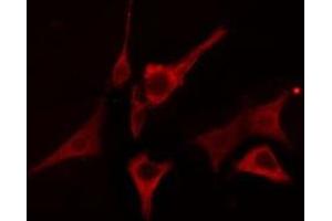 ABIN6276676 staining A549 cells by IF/ICC. (LIPC antibody  (Internal Region))