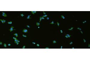 Immunofluorescence analysis of hela cell using SLC18A3 Polyclonal Antibody at dilution of 1:50 (SLC18A3 antibody)