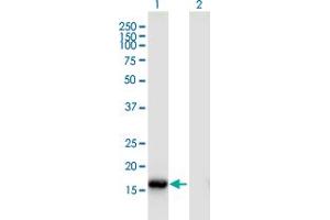 Western Blot analysis of ROBO3 expression in transfected 293T cell line by ROBO3 monoclonal antibody (M02), clone 2H1. (ROBO3 antibody  (AA 1-147))