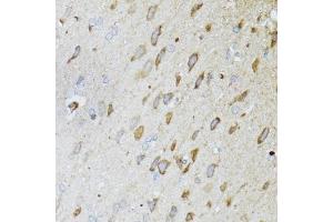 Immunohistochemistry of paraffin-embedded rat brain using MT-ND5 antibody (ABIN6135116, ABIN6144435, ABIN6144437 and ABIN6224158) at dilution of 1:100 (40x lens). (MT-ND5 antibody  (AA 500-600))