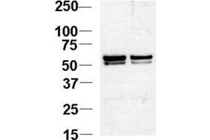 Western blot analysis of NL1 Antibody (N-term) 920b in Jurkat cell lysates. (NAP1L1 antibody  (N-Term))