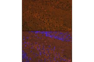 Immunofluorescence analysis of mouse brain using Mu Opioid Receptor(MOR) Rabbit pAb (ABIN7269101) at dilution of 1:100 (40x lens). (Mu Opioid Receptor 1 antibody  (C-Term))