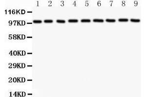 Western Blotting (WB) image for anti-Catenin (Cadherin-Associated Protein), alpha 1, 102kDa (CTNNA1) (AA 143-292) antibody (ABIN3043818) (CTNNA1 antibody  (AA 143-292))