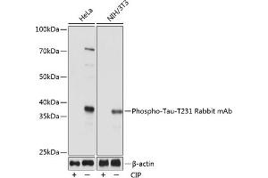 Western blot analysis of extracts of various cell lines, using Phospho-Tau-T231 Rabbit mAb (ABIN7268531) at 1:1000 dilution. (MAPT antibody  (pThr231))