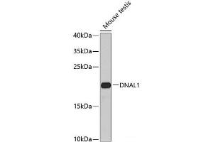 Western blot analysis of extracts of Mouse testis using DNAL1 Polyclonal Antibody at dilution of 1:1000.