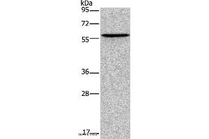 Western blot analysis of Human lung cancer tissue, using ADRA1B Polyclonal Antibody at dilution of 1:550