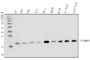 Western blot analysis of VAMP4 using anti-VAMP4 antibody (ABIN7598962).