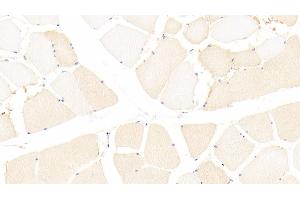 Detection of CCDC80 in Human Skeletal muscle Tissue using Polyclonal Antibody to Coiled Coil Domain Containing Protein 80 (CCDC80) (CCDC80 antibody  (AA 81-258))