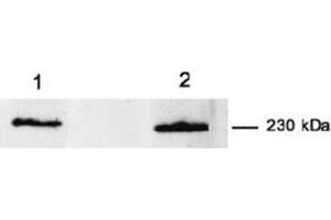Western Blotting (WB) image for anti-Myoferlin (MYOF) antibody (ABIN1108357) (Myoferlin antibody)