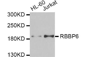 Western blot analysis of extracts of various cell lines, using RBBP6 antibody (ABIN5974190) at 1/1000 dilution. (RBBP6 antibody)