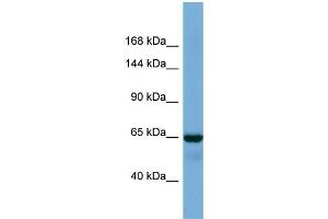 Host:  Rabbit  Target Name:  DKFZp686A1782  Sample Type:  Fetal Lung lysates  Antibody Dilution:  1. (PHC1 antibody  (C-Term))