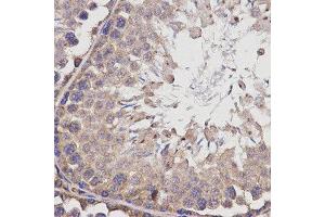 Immunohistochemistry (IHC) image for anti-Butyrylcholinesterase (BCHE) antibody (ABIN1871242) (Butyrylcholinesterase antibody)