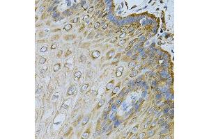 Immunohistochemistry of paraffin-embedded human esophagus using HSP90AB1 Antibody. (HSP90AB1 antibody  (AA 1-300))