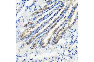 Immunohistochemistry of paraffin-embedded mouse lung using KMT2E antibody (ABIN6131786, ABIN6142983, ABIN6142984 and ABIN6221745) at dilution of 1:200 (40x lens). (MLL5/KMT2E antibody  (AA 200-500))