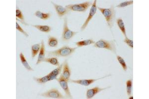 ICC testing of BiP antibody and HeLa cells (GRP78 antibody  (C-Term))