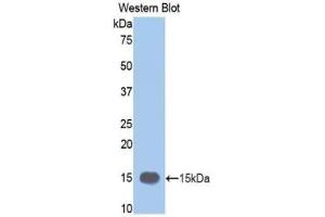 Western blot analysis of the recombinant protein. (MMP12 antibody  (AA 270-362))