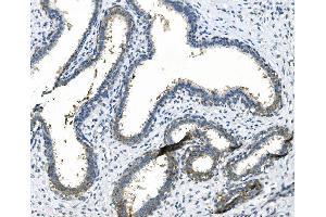 IHC analysis of LPP using anti LPP antibody (ABIN7602831). (LPP antibody  (C-Term))
