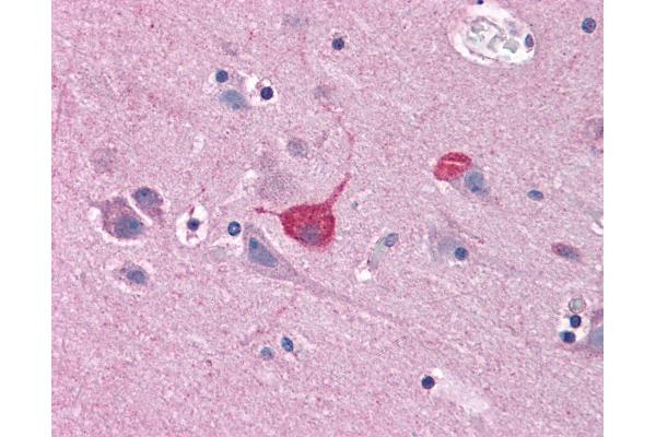 BOK antibody  (C-Term)