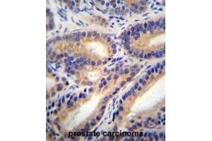 Immunohistochemistry (IHC) image for anti-Hydroxysteroid (11-Beta) Dehydrogenase 1-Like (HSD11B1L) antibody (ABIN2996215) (HSD11B1L antibody)