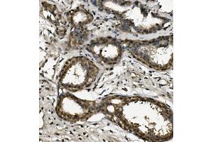 IHC analysis of RPA32/RPA2 using anti-RPA32/RPA2 antibody (ABIN7601380). (RPA2 antibody  (AA 34-254))