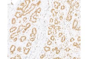 Immunohistochemistry (IHC) image for anti-Replication Protein A2, 32kDa (RPA2) (C-Term) antibody (ABIN7454599) (RPA2 antibody  (C-Term))