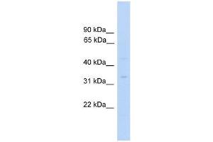 MTFMT antibody used at 0. (MTFMT antibody  (C-Term))