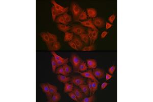 Immunofluorescence analysis of  cells using GART Rabbit pAb (ABIN1679954, ABIN3018225, ABIN3018226 and ABIN6220407) at dilution of 1:200 (40x lens). (GART antibody  (AA 1-320))