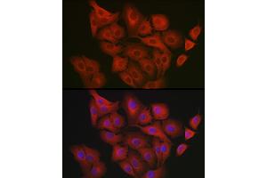 Immunofluorescence analysis of  cells using GART Rabbit pAb (ABIN1679954, ABIN3018225, ABIN3018226 and ABIN6220407) at dilution of 1:200 (40x lens). (GART antibody  (AA 1-320))