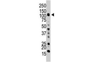 The UBA1 polyclonal antibody  is used in Western blot to detect UBA1 in HL-60 cell lysate. (UBA1 antibody  (C-Term))