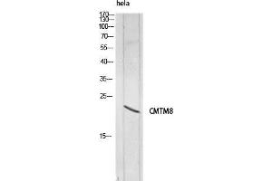 Western Blot (WB) analysis of HeLa lysis using CMTM8 antibody. (CMTM8 antibody)