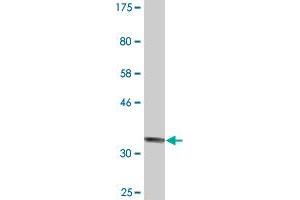 Western Blot detection against Immunogen (34. (RIMS2 antibody  (AA 181-260))