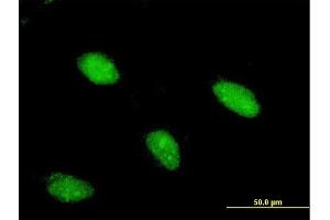 Immunofluorescence of monoclonal antibody to ARX on HeLa cell. (Arx antibody  (AA 1-95))