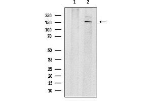 Western blot analysis of lysates from MDA-M, using GASP1 Antibody.