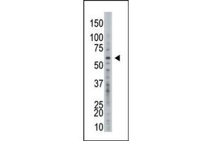 Image no. 1 for anti-Ubiquitin Specific Peptidase 21 (USP21) (C-Term) antibody (ABIN357556) (USP21 antibody  (C-Term))