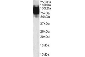 Western Blotting (WB) image for anti-Kruppel-Like Factor 4 (Gut) (KLF4) (N-Term) antibody (ABIN2465877) (KLF4 antibody  (N-Term))