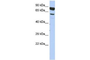 WB Suggested Anti-DPY19L4 Antibody Titration: 0. (DPY19L4 antibody  (Middle Region))