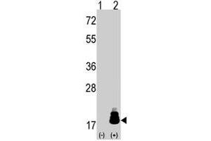 Western blot analysis of EIF4EBP1 (arrow) using rabbit EIF4EBP1 polyclonal antibody . (eIF4EBP1 antibody  (Thr69))