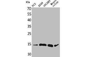Western Blot analysis of PC-3 A549 OVCAR3 mouse colon cells using Eotaxin-3 Polyclonal Antibody