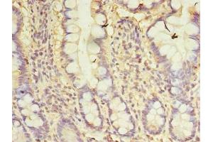 Immunohistochemistry of paraffin-embedded human small intestine tissue using ABIN7146141 at dilution of 1:100 (CXCL6 antibody  (AA 38-114))