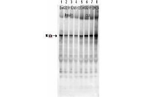 Affinity Purified Phospho-specific antibody to human muscle Glycogen Synthase (GS) at pS640 was used at a 1:1000 dilution to detect human muscle GS by Western blot. (Glycogen Synthase 1 antibody  (pSer640))