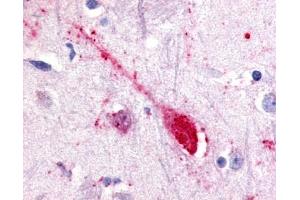 Immunohistochemical staining of Putamen (Neuron) using anti- GPR85 antibody ABIN122575 (GPR85 antibody)
