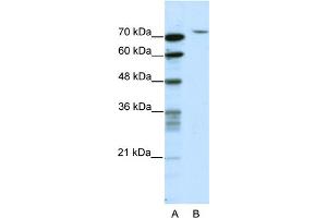 WB Suggested Anti-TAF6 Antibody Titration:  2. (TAF6 antibody  (N-Term))