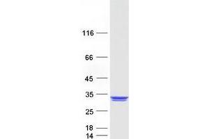 Western Blotting (WB) image for REX2, RNA Exonuclease 2 Homolog (REXO2) protein (Myc-DYKDDDDK Tag) (ABIN2730766)