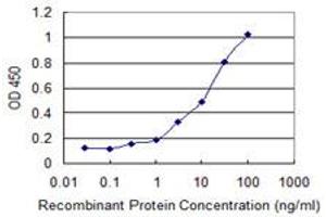 Detection limit for recombinant GST tagged KRIT1 is 0. (KRIT1 antibody  (AA 637-736))