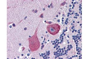 Immunohistochemistry (IHC) image for anti-Cerebellin 4 Precursor (CBLN4) (C-Term) antibody (ABIN2784954) (CBLN4 antibody  (C-Term))