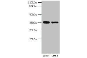 Western blot All lanes: MGME1 antibody at 1 μg/mL Lane 1: Jurkat whole cell lysate Lane 2: 293T whole cell lysate Secondary Goat polyclonal to rabbit IgG at 1/10000 dilution Predicted band size: 39 kDa Observed band size: 39 kDa (C20orf72 antibody  (AA 81-260))